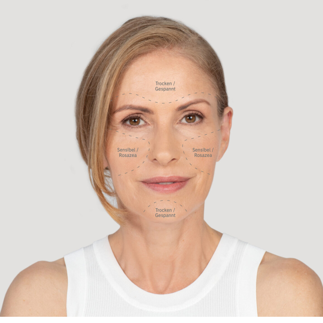 Eine blonde Frau mittleren Alters, der man ihre Hautprobleme ins Gesicht geschrieben hat, um ihren Hauttyp zu bestimmen und zu erklären.