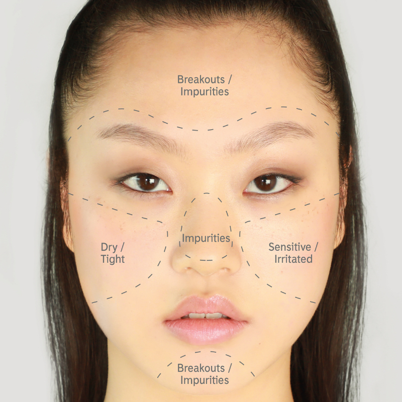 Combination skin usually has an oily t zone with possible outbreaks of spots and blackheads but cheeks which are dry and dehydrated