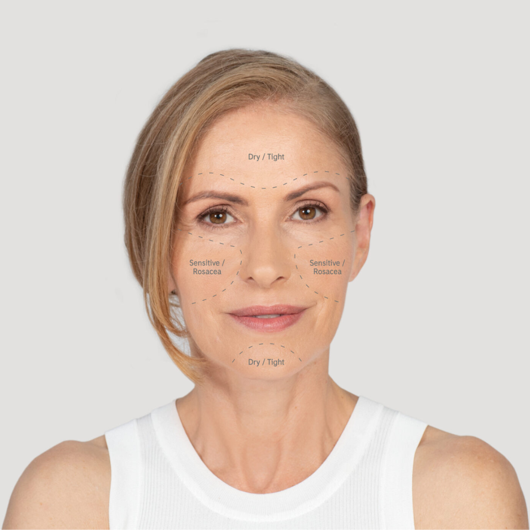 A middle aged blonde woman with her skin concerns written on her face to establish and explain her skin type.