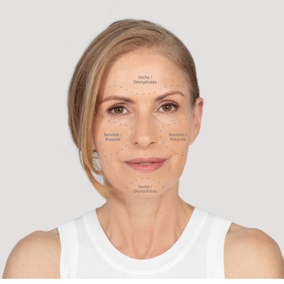 Une femme blonde d'âge moyen avec ses problèmes de peau inscrits sur son visage pour établir et expliquer son type de peau pour le blog d'Elixseri sur les types de peau.