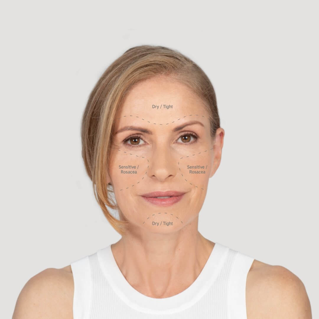 A middle aged blonde woman with her skin concerns written on her face to establish and explain her skin type. 