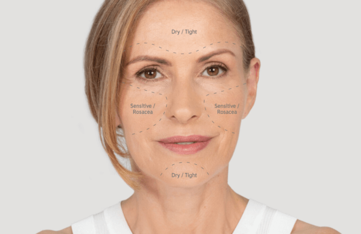 A middle aged blonde woman with her skin concerns written on her face to establish and explain her skin type